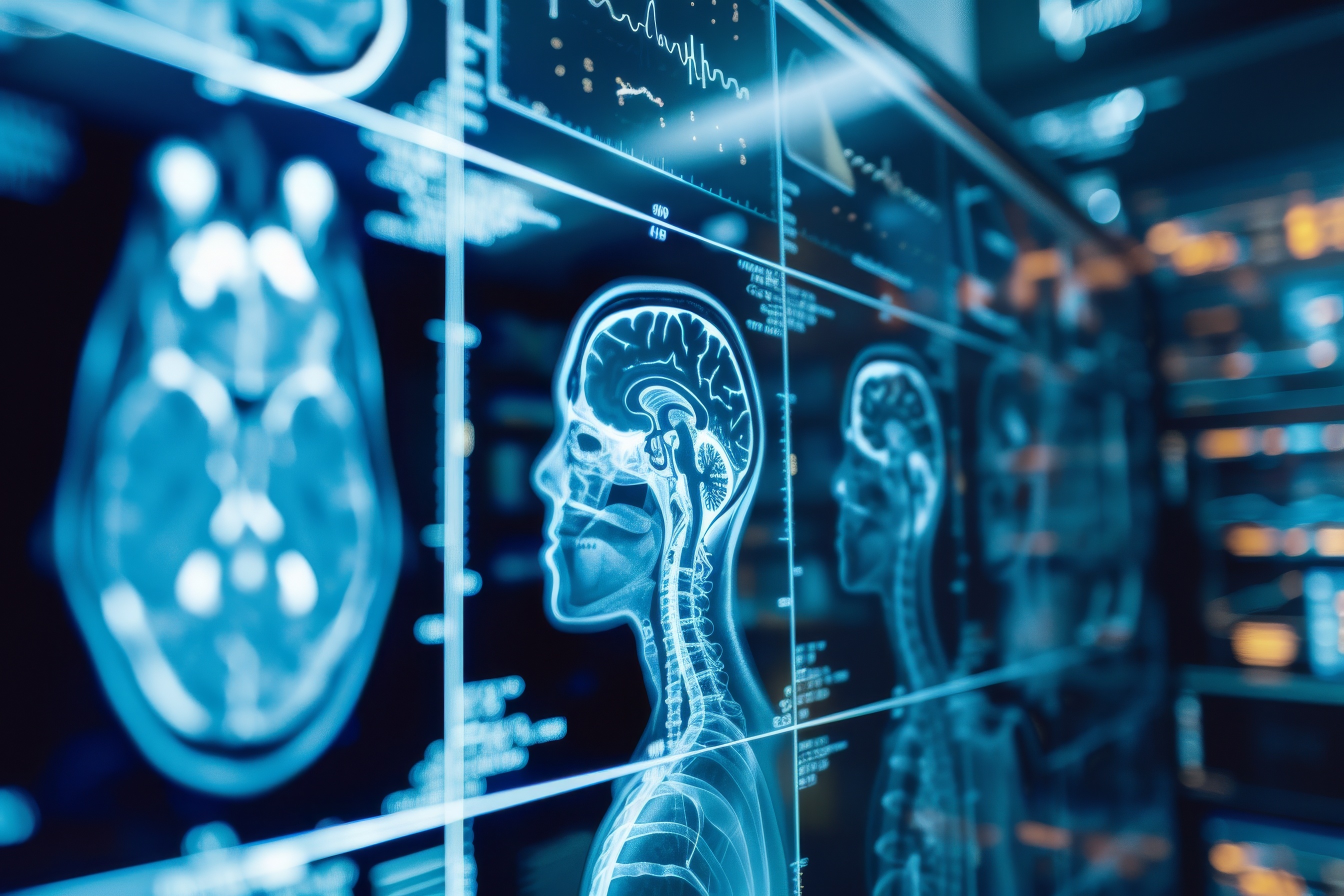 Grupo de Investigación en Neurotrauma